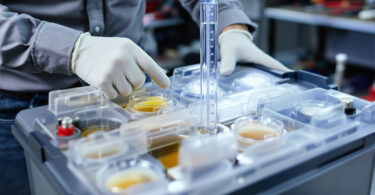 découvrez comment vérifier facilement le niveau d'électrolyte d'une batterie avec bouchons pour assurer son bon fonctionnement et prolonger sa durée de vie.